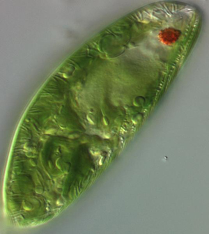 euglena_alga_cancro